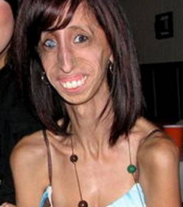 Nommée femme la plus moche du