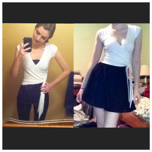 Avant /après 14 personnes qui sont venues à bout de l'anorexie