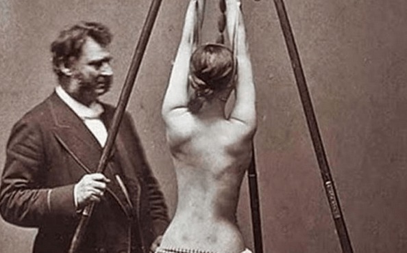 11 méthodes médicales un peu barbares  qu’on utilisait autrefois