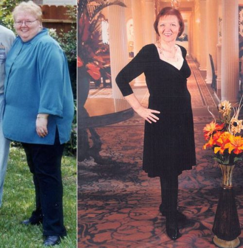 great-weight-loss-photos-16
