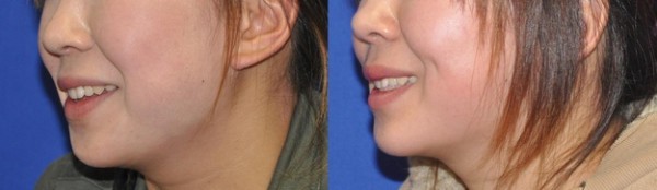 enhanced-buzz-8531-1383155841-41