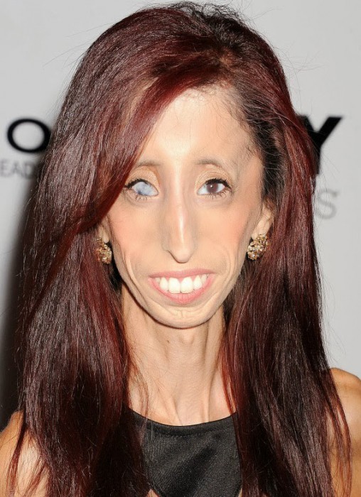 Nommée femme la plus moche du