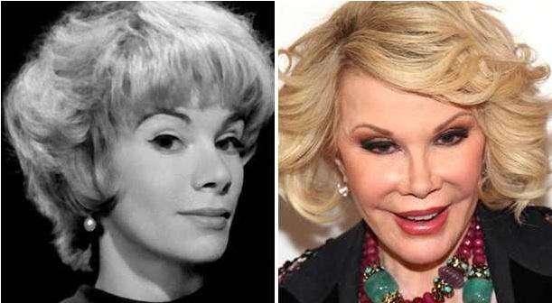 Joan Rivers