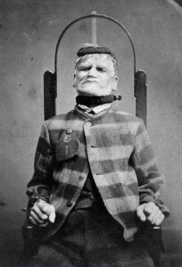 Patient-in-restraint-chair-at-the-West-Riding-Lunatic-Asylum-Wakefield-Yorkshire-ca.-1869