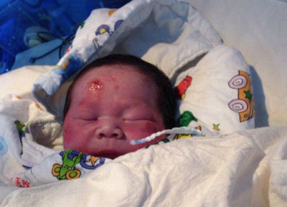 Miracle Un Bebe Expulse Du Ventre De Sa Mere Pendant Un Accident De Moto Miracle Un Bebe Expulse Du Ventre De Sa Mere Pendant Un Accident De Moto