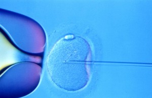 Intracytoplasmic_sperm_injection