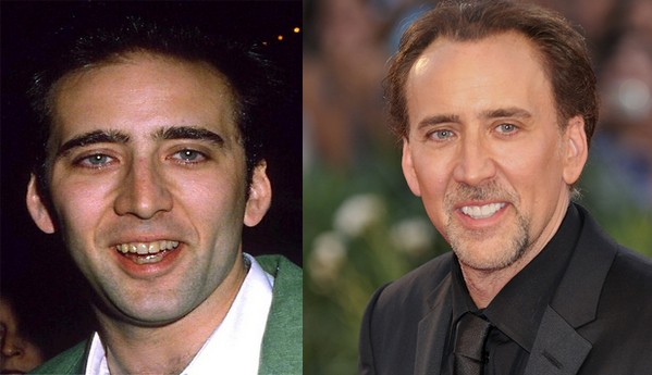 13dents-stars-av7654