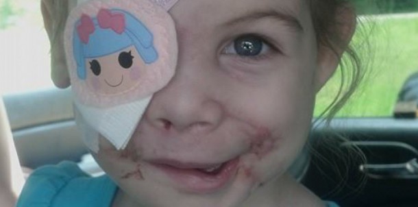 7424339-defiguree-par-des-pitbulls-une-fillette-refusee-au-kfc