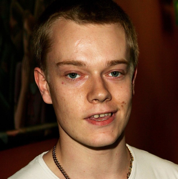 Alfie Allen (Theon Greyjoy) en 2007