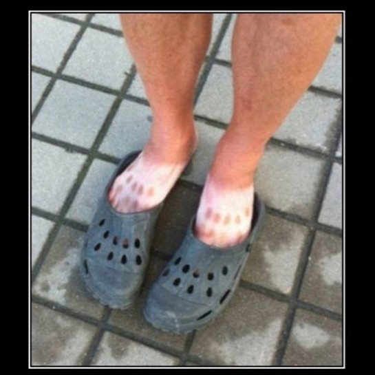 bronzage-fail-16-545x545