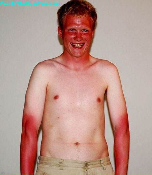 bronzage-fail-5