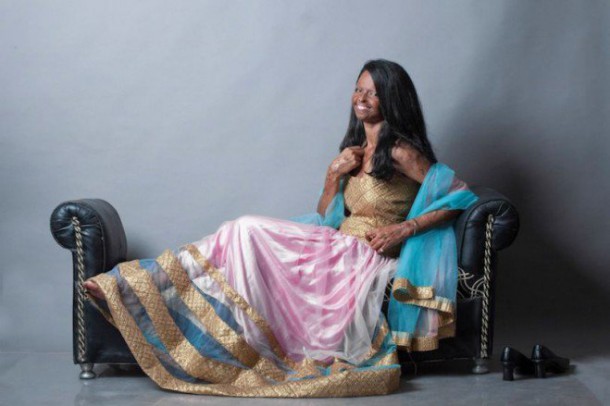 femmes_acide-2-659x439