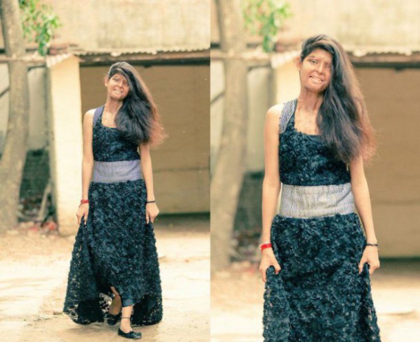 femmes_acide-3-659x537