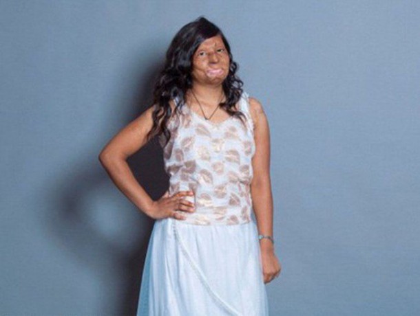 femmes_acide-6-659x497