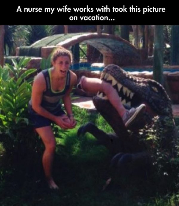 amputated-funny-humor-photos-12