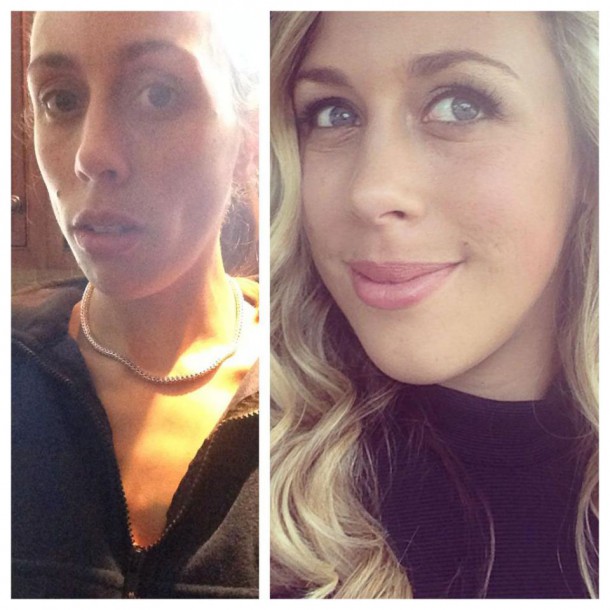 jeune-femme-changement-anorexie