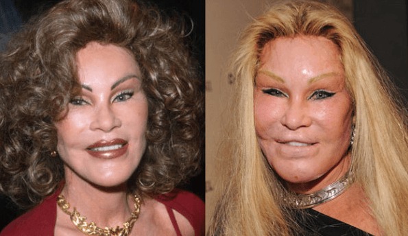 Jocelyn Wildenstein