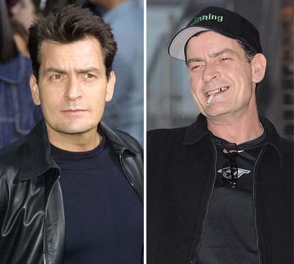 charlie-sheen-shocking-celebrity-transformation_-_1