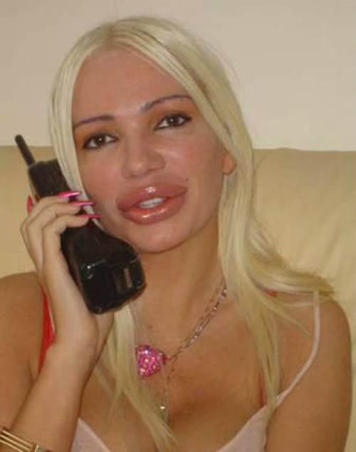 huge-lips-16