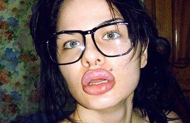 lips-image-1-94194580