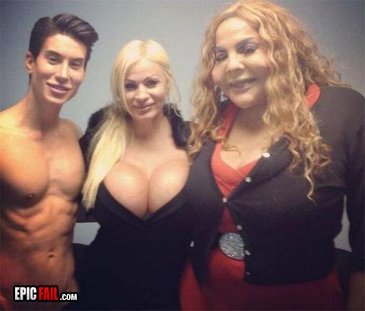 plastic-surgery-fail