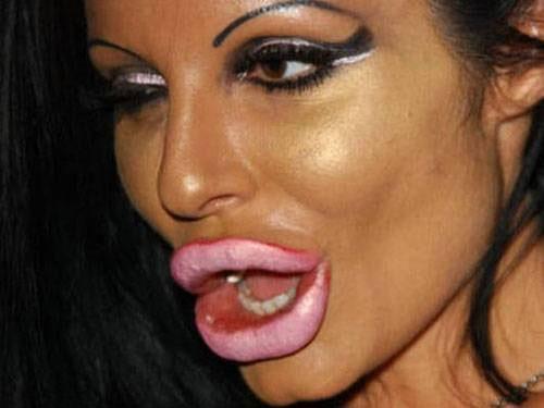 plastic-surgery-fails