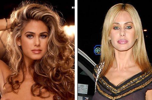 plastic_surgery_fails_19