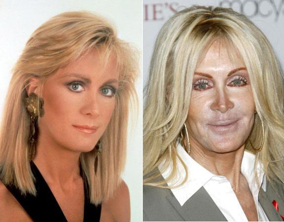 plastic_surgery_fails_8