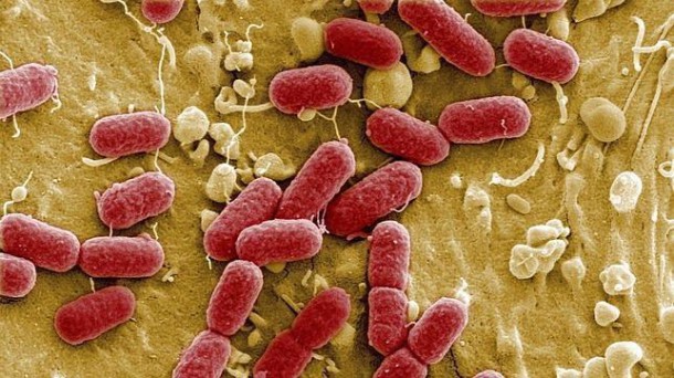 Escherichia coli (bactérie)