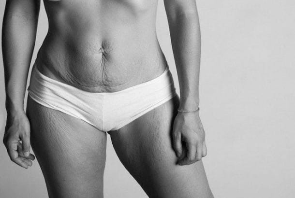 postpartum-photography-mothers-after-pregnancy-beautiful-body-project-jade-beall-4-L