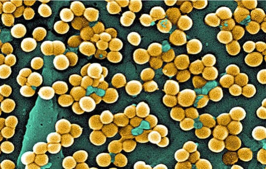 Staphylocoque doré (bactérie)
