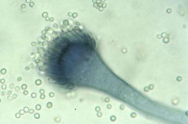 Aspergillus fumigatus
