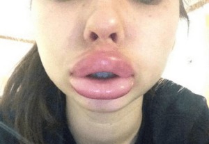 #KylieJennerChallenge