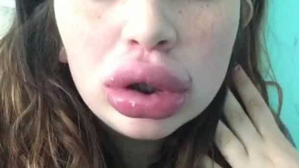 levres-pulpeuses-challenge-5