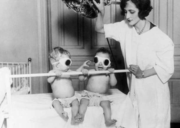 Des UV pour soigner des enfants trop "rachitiques"