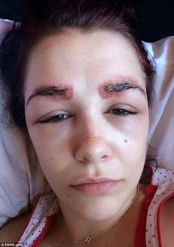 2ADFEB1A00000578-3175932-Polly_Smith_suffered_a_severe_allergic_reaction_leaving_her_with-a-32_1437998773174