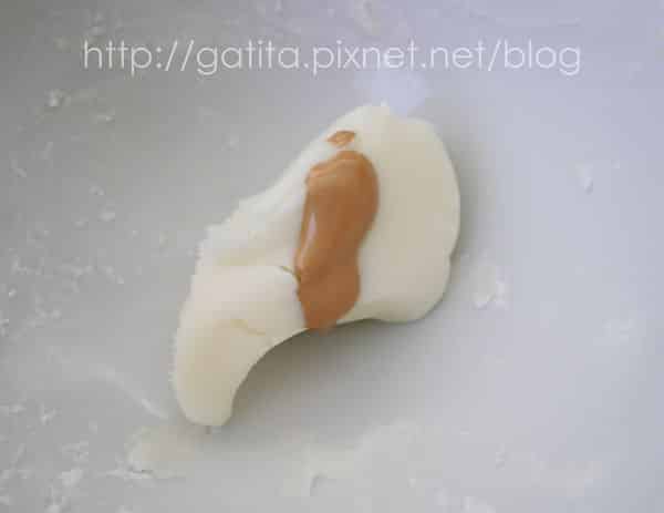 rhinoplastie