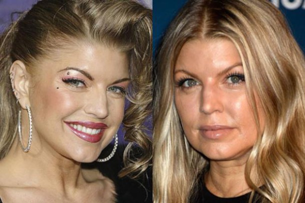 Fergie - La chanteuse a mis du temps à revenir de sa descente en enfer.