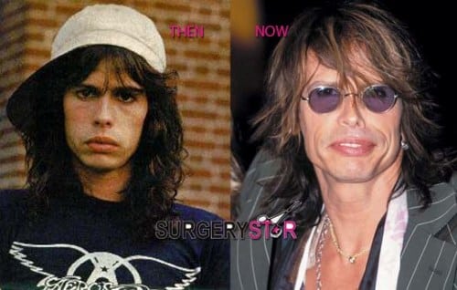 Steven Tyler - Le chanteur d'Aerosmith a toujours assumé sa consommation de drogue. 