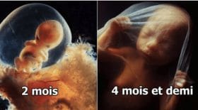 foetus