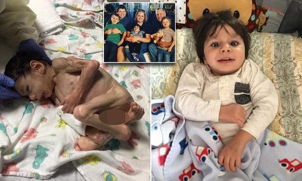 A L Age De 7 Ans Il Ne Pesait Que 4 Kilos Regardez Ce Qu Il Est Devenu Aujourd Hui