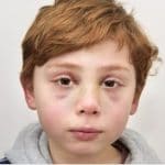 enfant maltraité