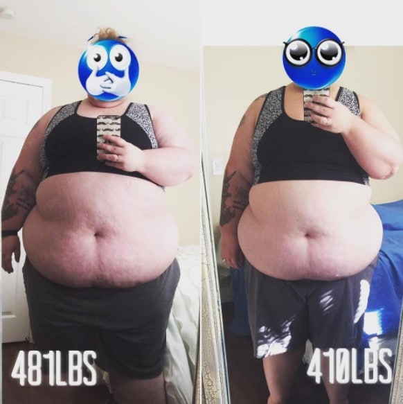 obesite avant apres obesite avant apres