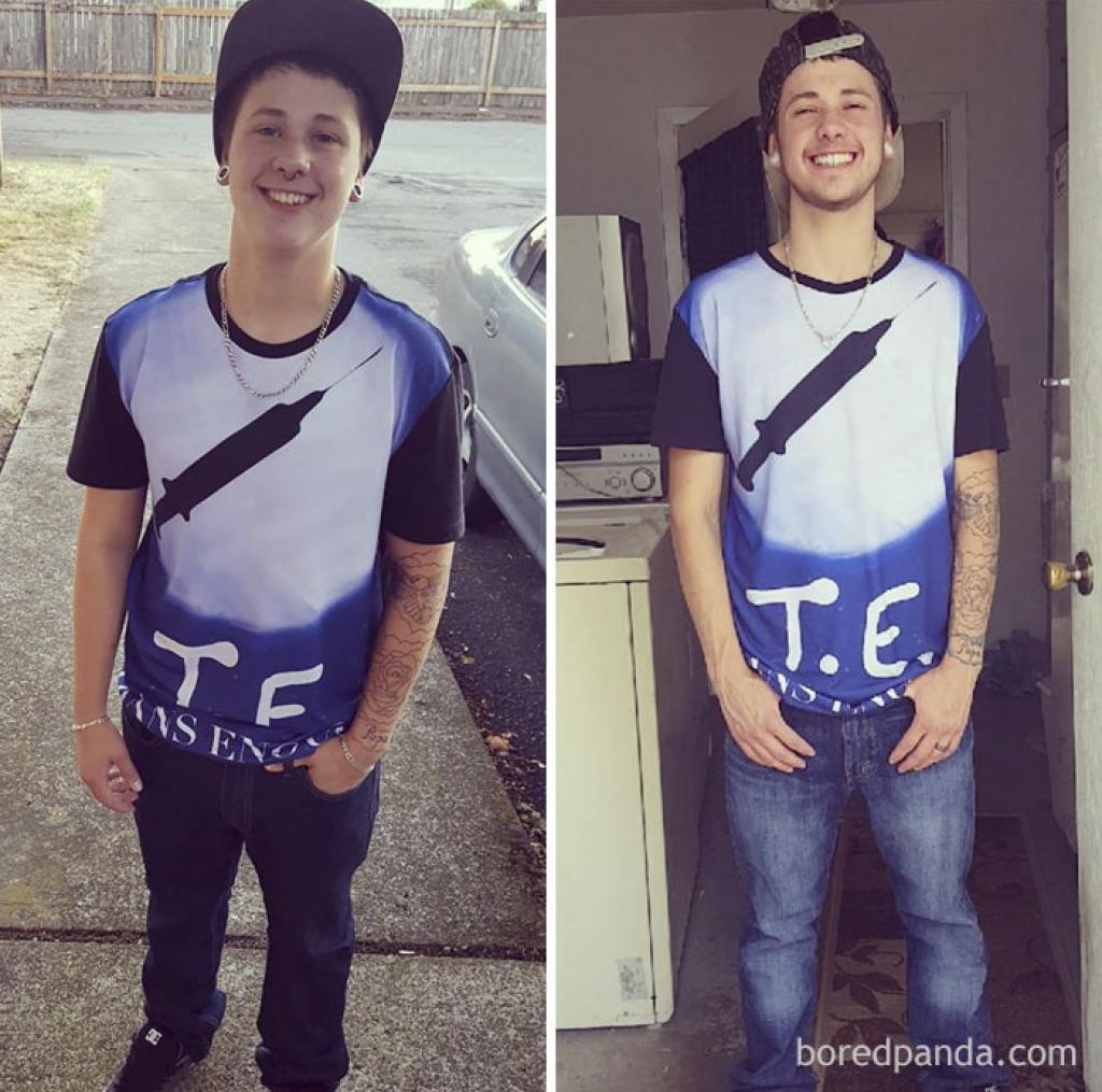 Смена пола фото до и после. Трансгендерная девушка в америке. Трансгендер до операции. Операция по перемене пола. Из мужчины в женщину фото.