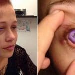 tatouer l'oeil