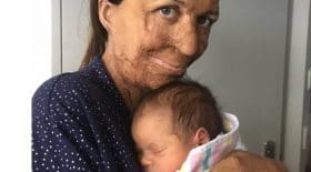 turia pitt