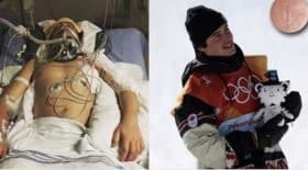 Mark McMorris