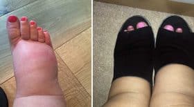 pieds