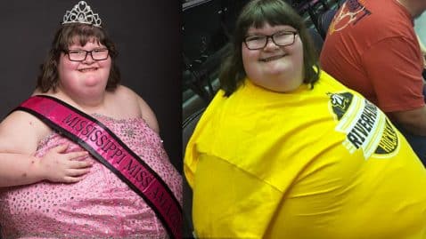 maladie prader-willi a toujours faim miss amazing