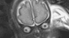 alien echographie